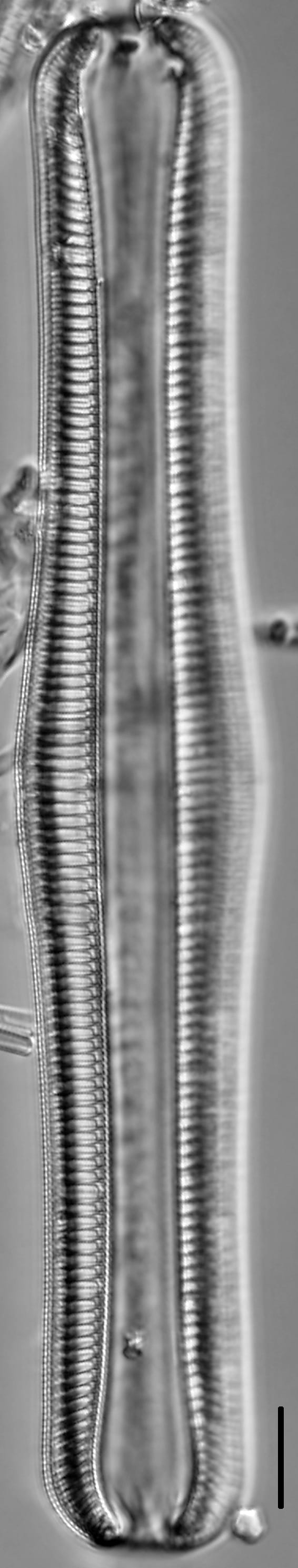 Rhopalodia gibba LM5