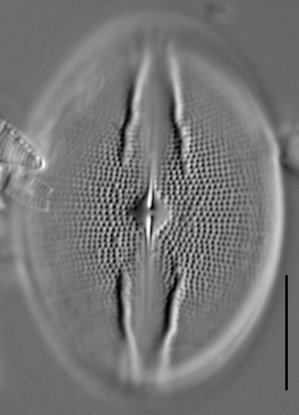 Cocconeis rugosa LM1