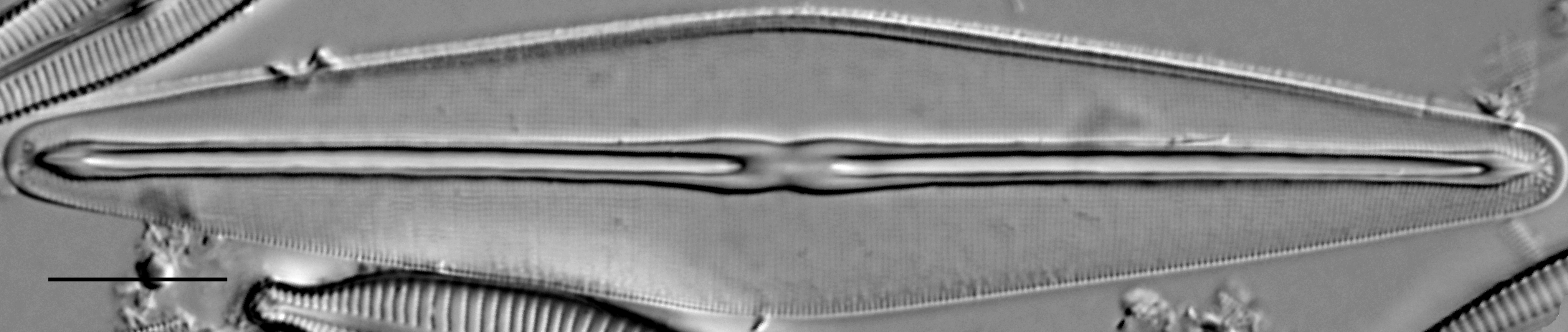 Frustulia saxonica LM7