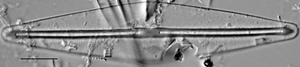 Frustulia saxonica LM6
