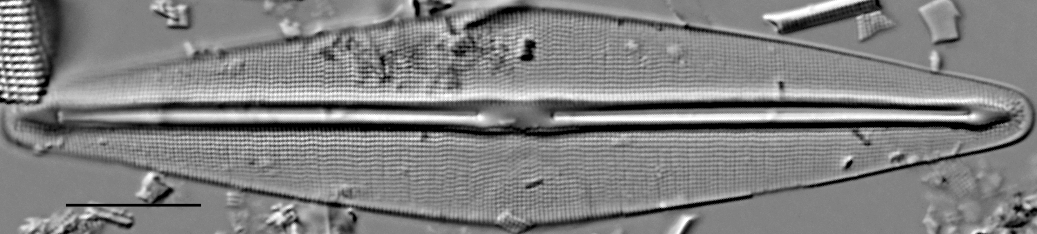 Frustulia saxonica LM5
