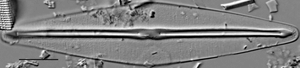 Frustulia saxonica LM5