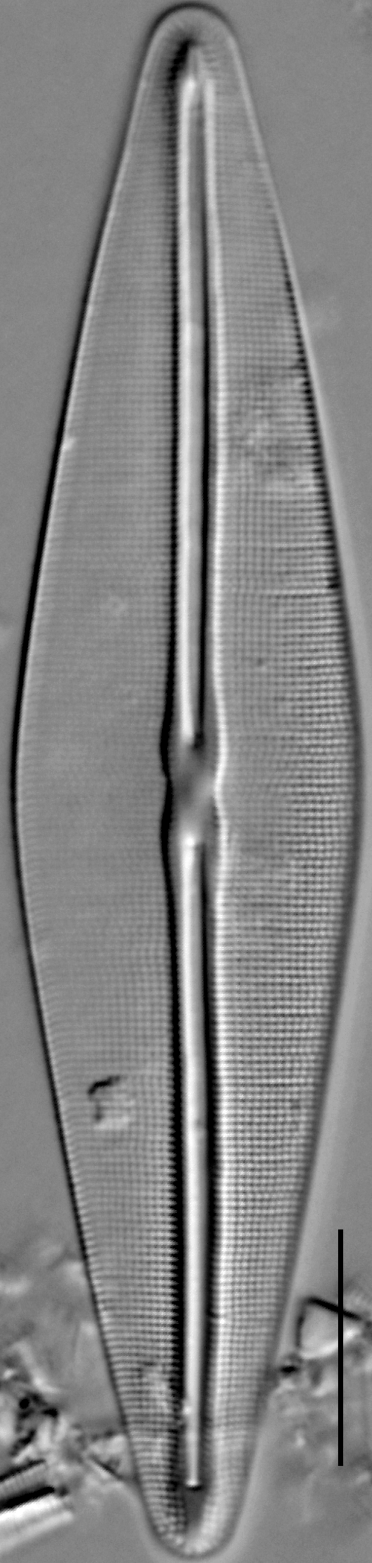 Frustulia saxonica LM4