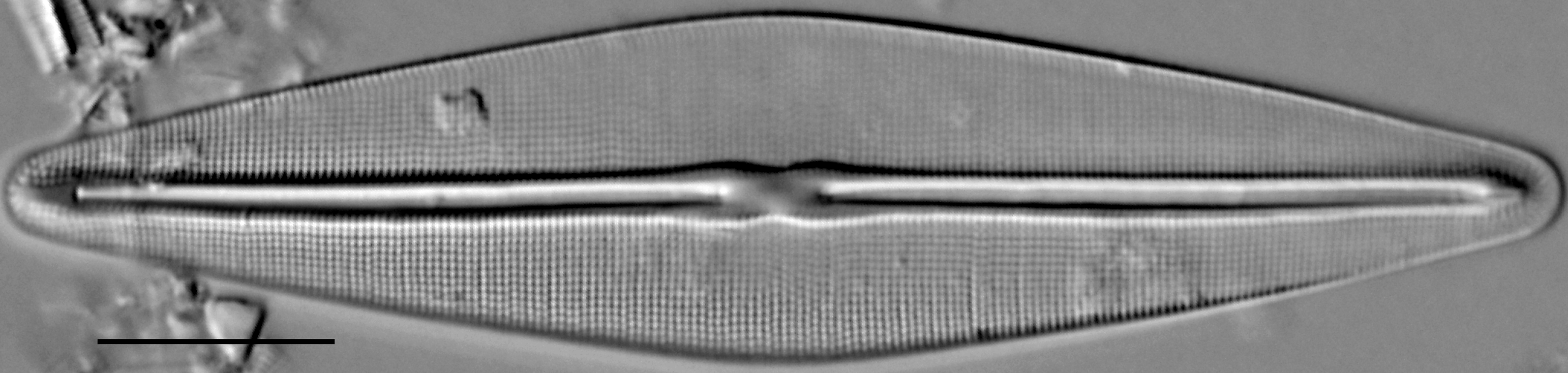 Frustulia saxonica LM4