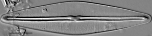 Frustulia saxonica LM4