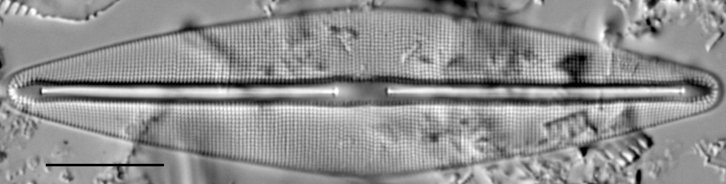 Frustulia saxonica LM3