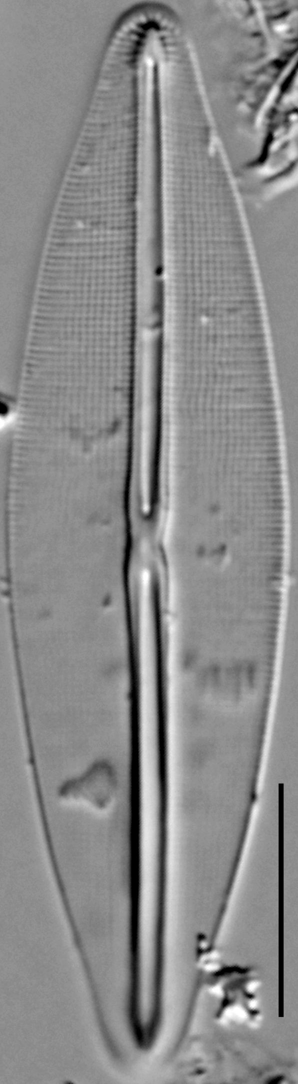 Frustulia saxonica LM1