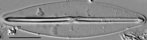 Frustulia saxonica LM1