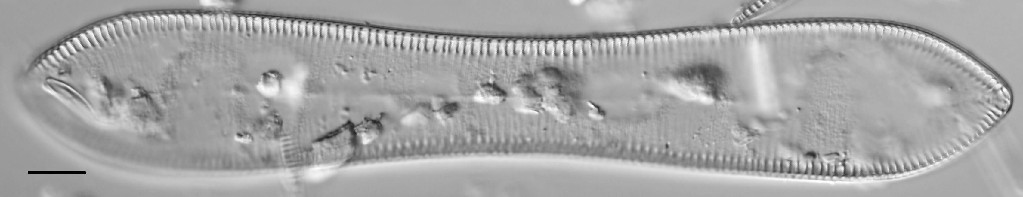 Cymatopleura solea LM1