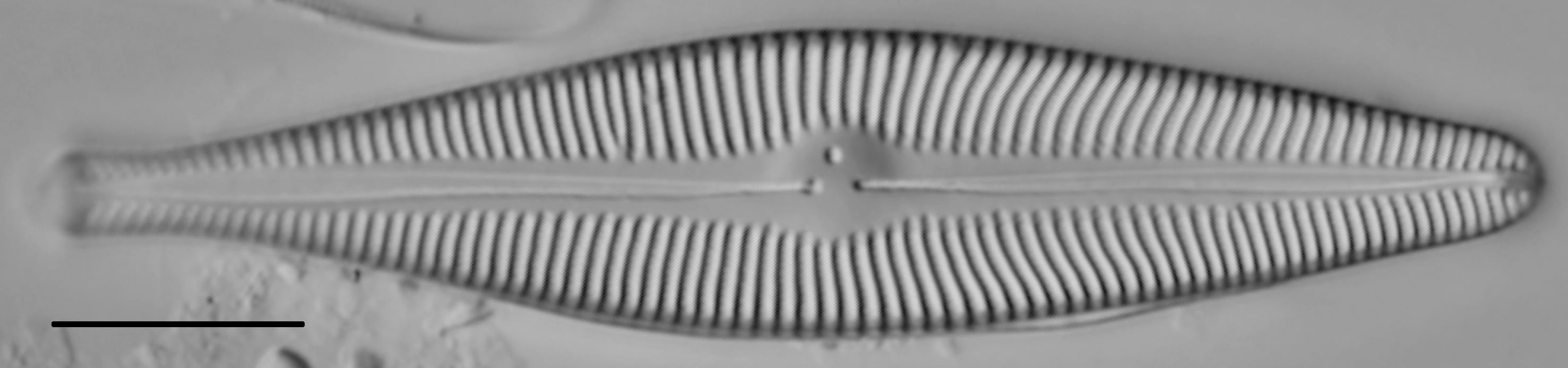 Gomphoneis septa LM5