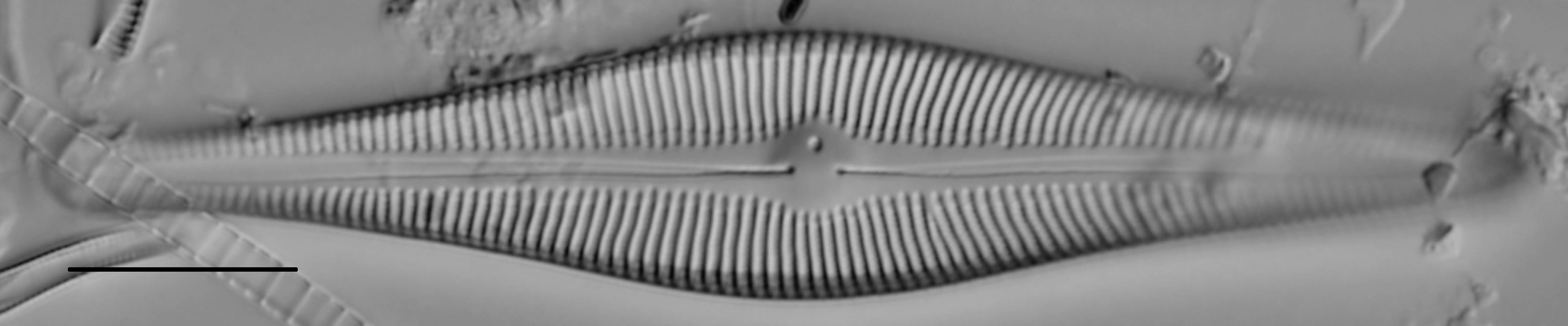 Gomphoneis septa LM3