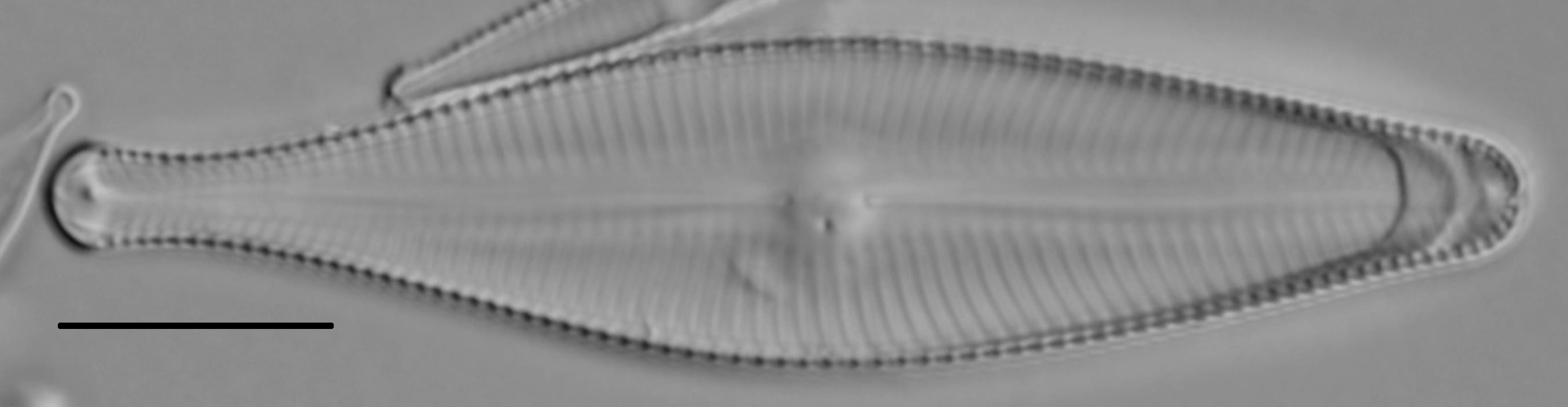 Gomphoneis septa LM2