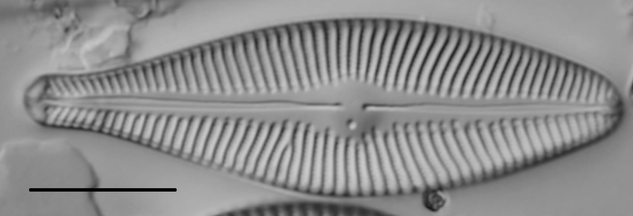 Gomphoneis septa LM1