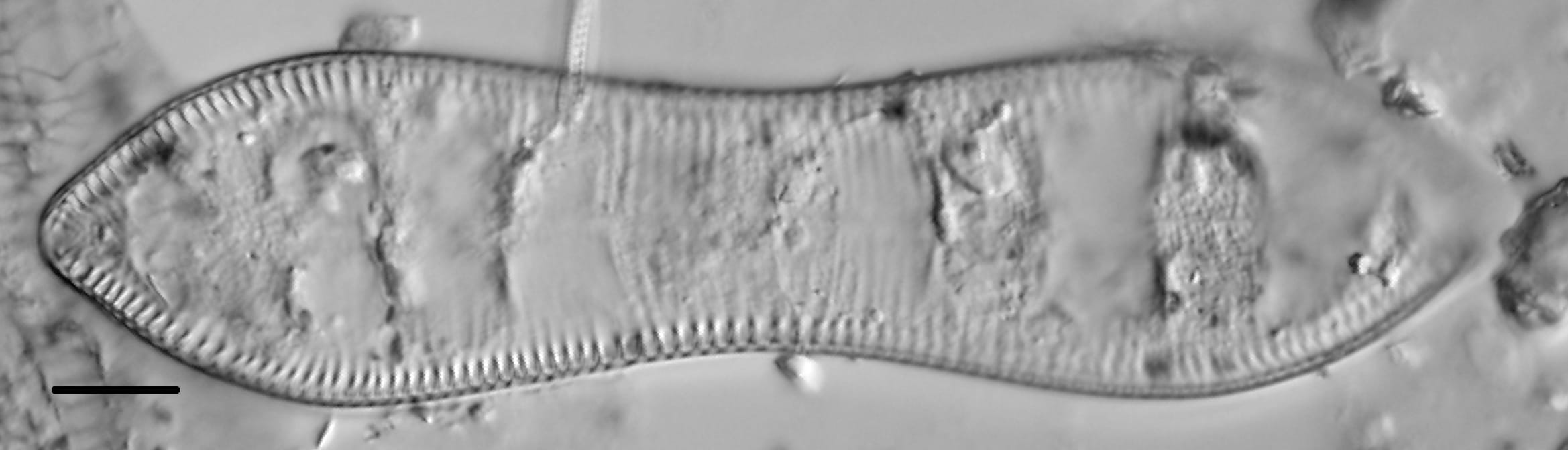 Cymatopleura solea LM3