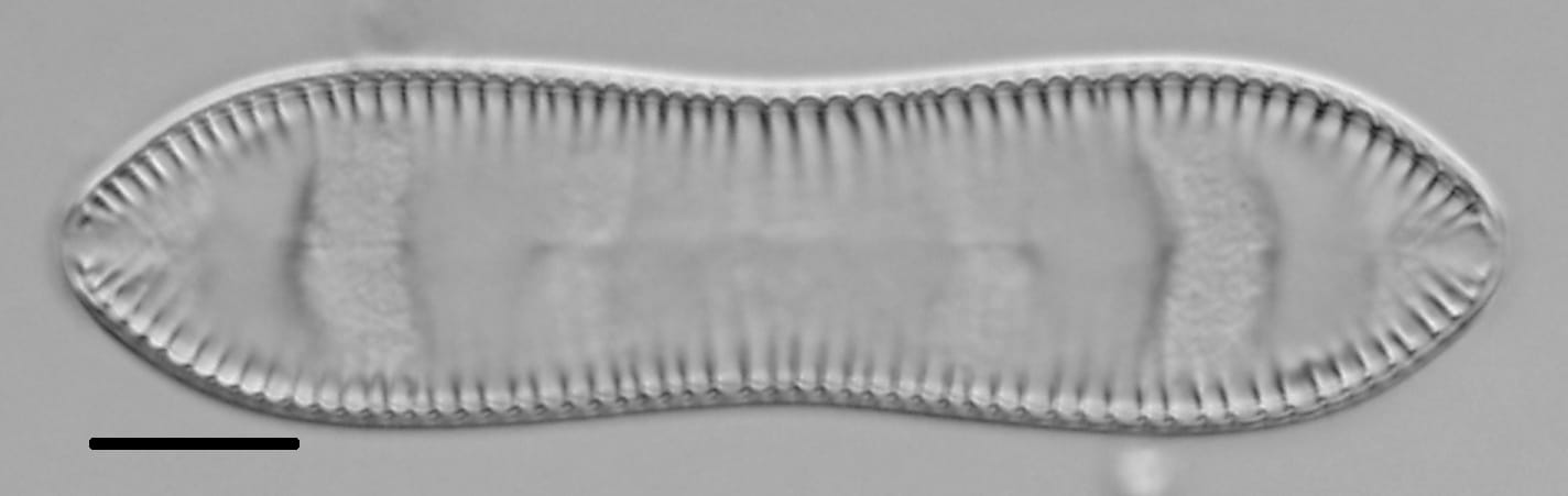 Cymatopleura solea LM4