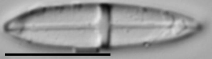 Stauroneis smithii var incisa LM7