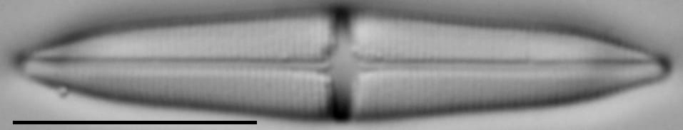 Stauroneis smithii var incisa LM6