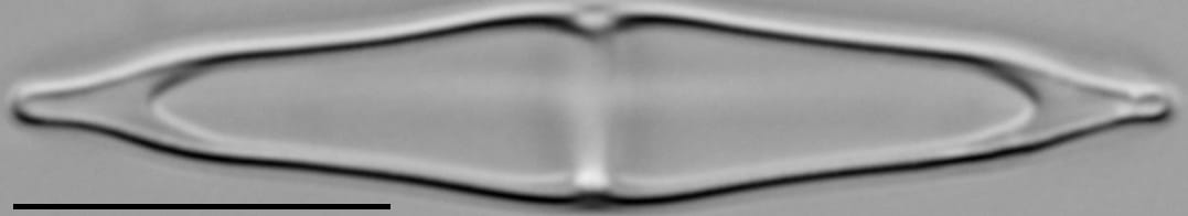 Stauroneis smithii var incisa LM3