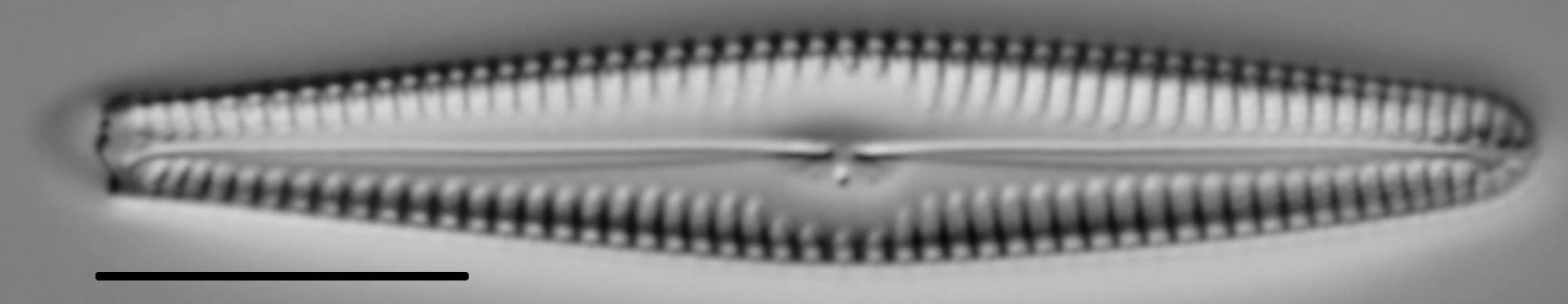 Gomphonema stoermeri LM7