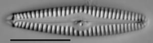 Gomphonema stoermeri LM5