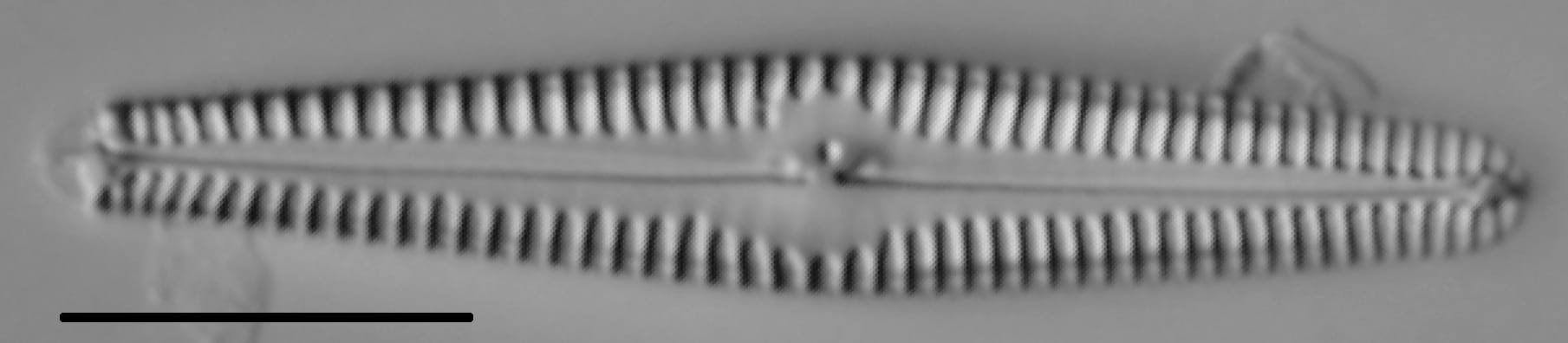 Gomphonema stoermeri LM2