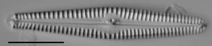 Gomphonema stoermeri LM2