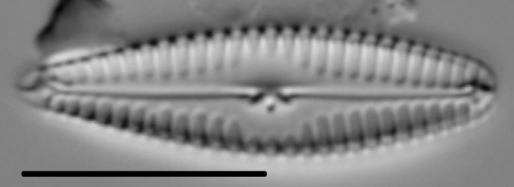 Gomphonema stoermeri LM1