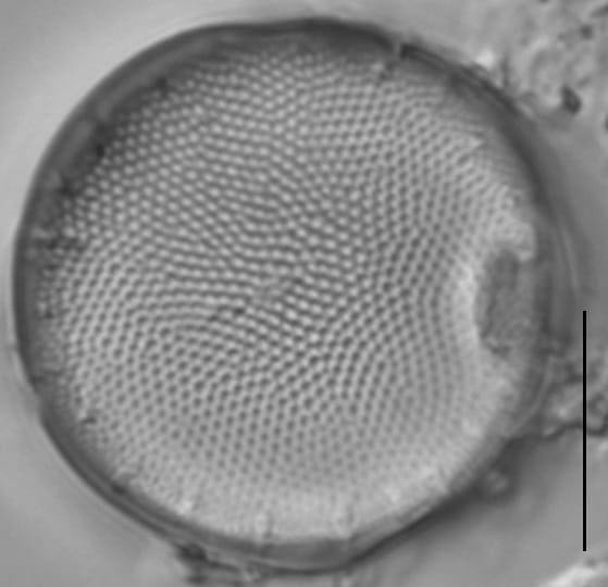 Thalassiosira baltica LM13