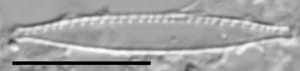 Nitzschia palea var tenuirostris LM2