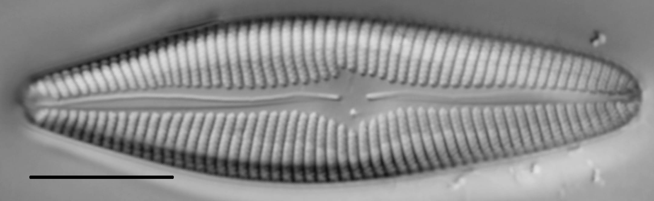 Gomphoneis trullata LM7