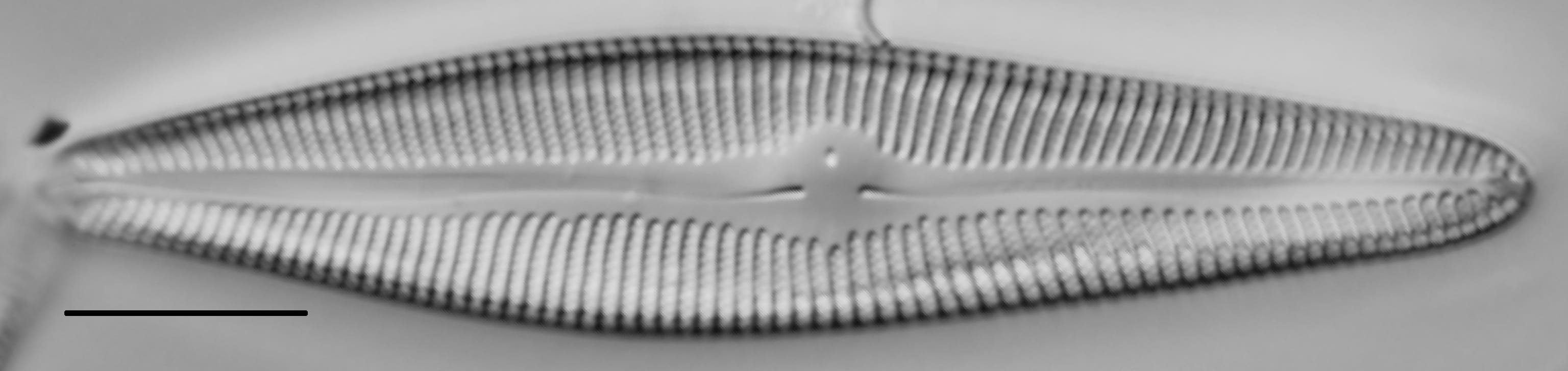 Gomphoneis trullata LM6