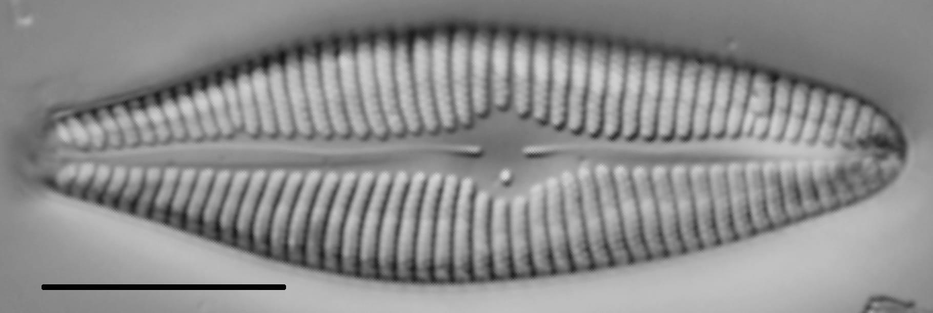 Gomphoneis trullata LM4