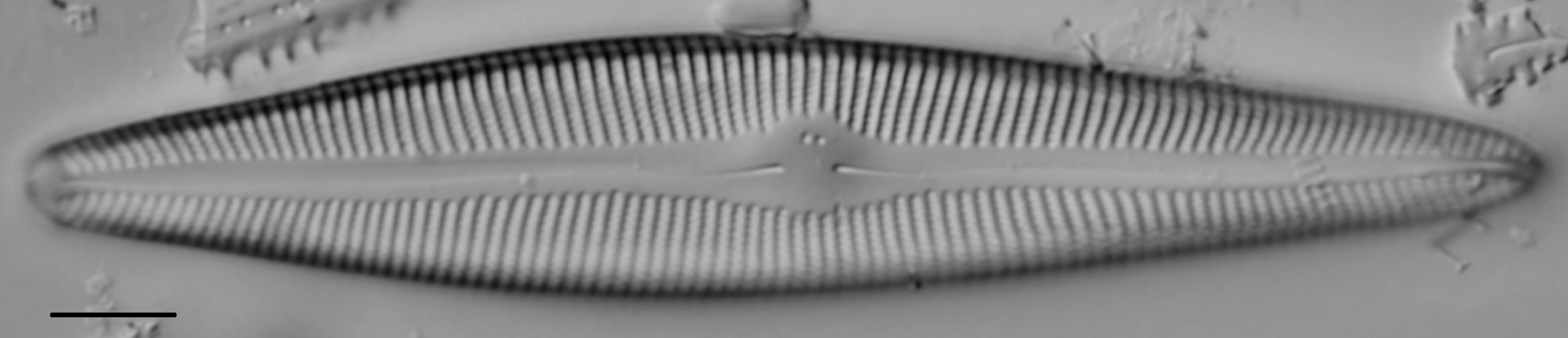 Gomphoneis trullata LM1