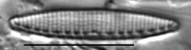 Nitzschia valdecostata LM7
