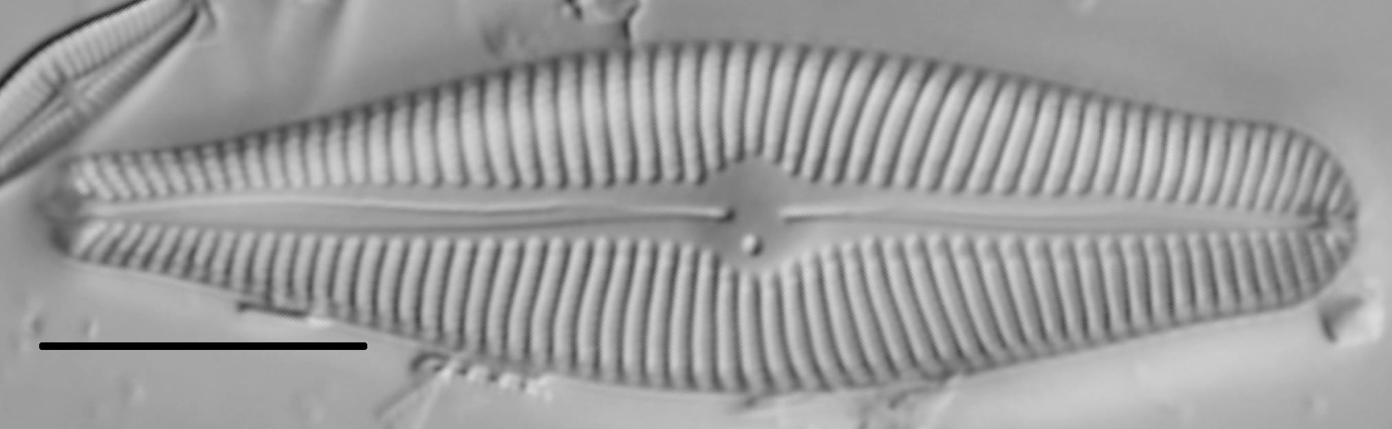 Gomphoneis eriense var variabilis LM5