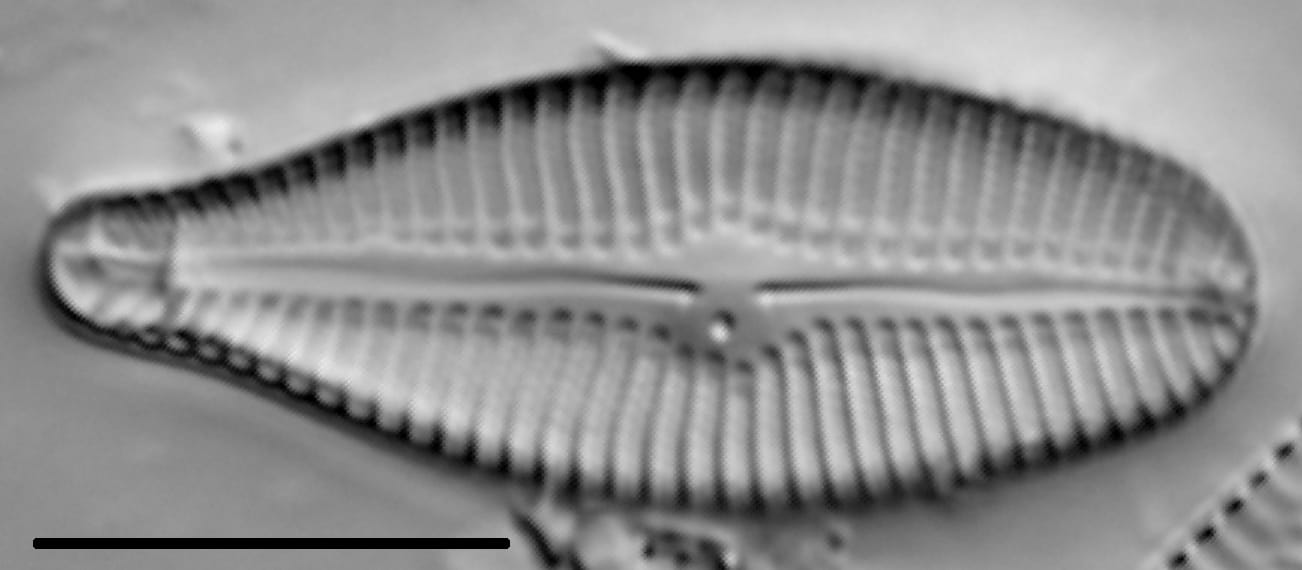 Gomphoneis eriense var variabilis LM4