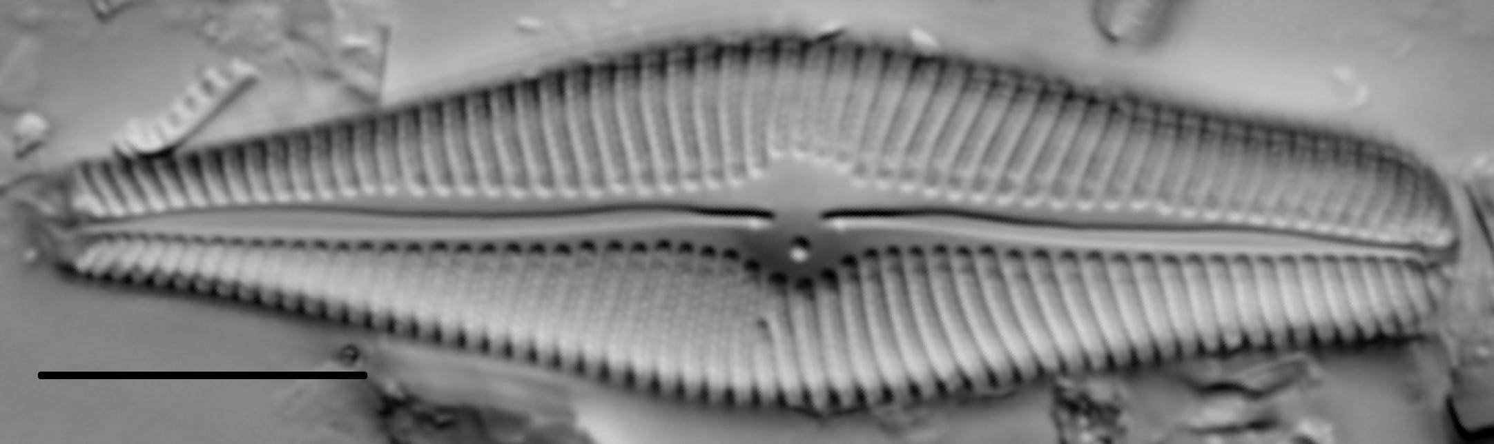 Gomphoneis eriense var variabilis LM3