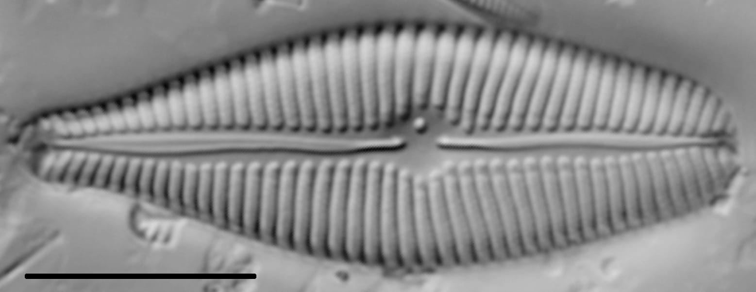 Gomphoneis eriense var variabilis LM1